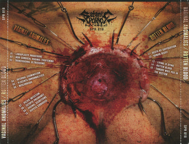 Vaginal Anomalies, Rotten Blood (2) : Rotten Vaginal Gore (CD, Album)